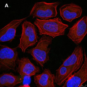 Anti-p-Ubiquitin (pSer65) Antibody, clone 2N21 ZooMAb&#174; Rabbit Monoclonal recombinant, expressed in HEK 293 cells