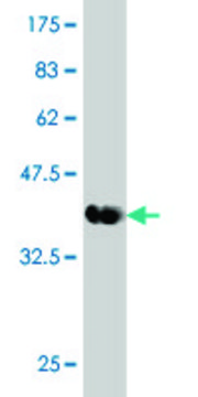 Monoclonal Anti-DYRK1A antibody produced in mouse clone 7D10, purified immunoglobulin, buffered aqueous solution