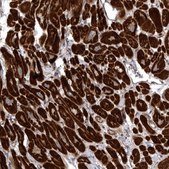 Anti-SNX16 antibody produced in rabbit Prestige Antibodies® Powered by Atlas Antibodies, affinity isolated antibody, buffered aqueous glycerol solution