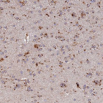 Anti-ARL8A antibody produced in rabbit Prestige Antibodies&#174; Powered by Atlas Antibodies, affinity isolated antibody, buffered aqueous glycerol solution