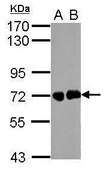 Anti-Helicobacter pylori urease B antibody produced in rabbit