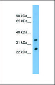 Anti-CHMP4B antibody produced in rabbit affinity isolated antibody