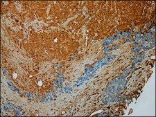 Anti-STX18 affinity isolated antibody