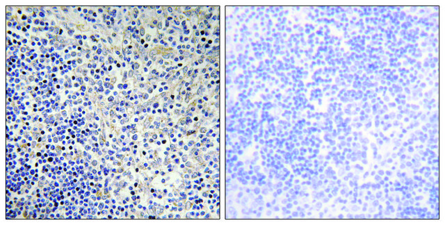 Anti-TPIP1, antibody produced in rabbit affinity isolated antibody