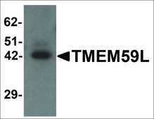 Anti-TMEM59L antibody produced in rabbit affinity isolated antibody