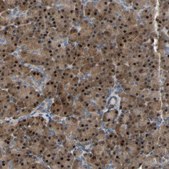 Anti-CROT antibody produced in rabbit Prestige Antibodies® Powered by Atlas Antibodies, affinity isolated antibody, buffered aqueous glycerol solution, Ab1