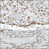 Anti-ZSCAN4 antibody produced in rabbit Prestige Antibodies® Powered by Atlas Antibodies, affinity isolated antibody, buffered aqueous glycerol solution