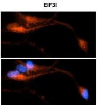 Anti-EIF3I (C-terminal) antibody produced in rabbit affinity isolated antibody