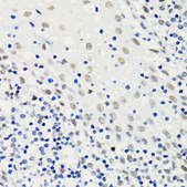 Anti-Acetyl-Histone H4-K5 antibody produced in rabbit