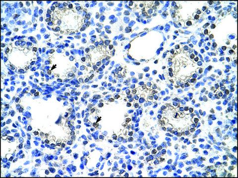 Anti-NR2C1 antibody produced in rabbit affinity isolated antibody