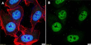 Anti-HNRNPK Antibody, clone 2C9 ZooMAb® Rabbit Monoclonal recombinant, expressed in HEK 293 cells