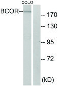 Anti-BCOR antibody produced in rabbit affinity isolated antibody