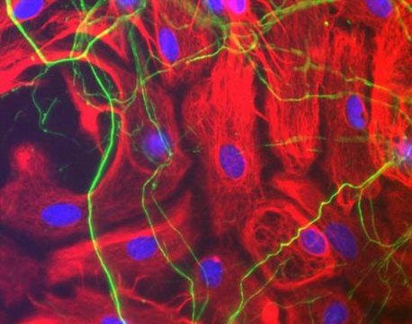 Anti-Neurofilament H Antibody Chemicon&#174;, from chicken