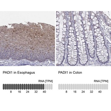 Anti-PADI1 antibody produced in rabbit Prestige Antibodies&#174; Powered by Atlas Antibodies, affinity isolated antibody, buffered aqueous glycerol solution