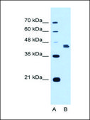 Anti-DFNA5 antibody produced in rabbit IgG fraction of antiserum