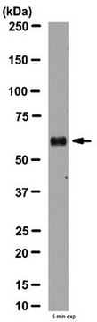 Anti-Aromatase Antibody from rabbit, purified by affinity chromatography