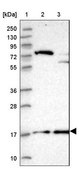 Anti-POLR2D antibody produced in rabbit Prestige Antibodies® Powered by Atlas Antibodies, affinity isolated antibody, buffered aqueous glycerol solution