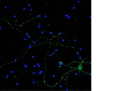 Anti-Neurofilament H Antibody, clone NE14, Alexa Fluor&#8482; 488 Conjugated clone NE14, from mouse, ALEXA FLUOR&#8482; 488