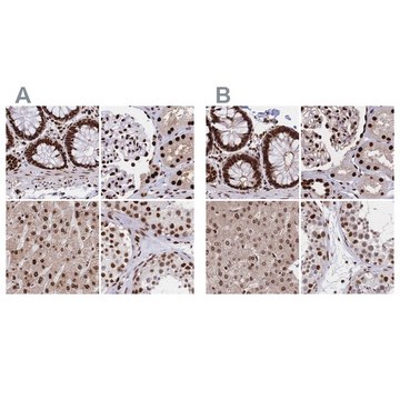 Anti-HDGF antibody produced in rabbit Prestige Antibodies&#174; Powered by Atlas Antibodies, affinity isolated antibody, buffered aqueous glycerol solution