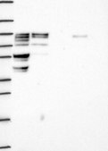 Anti-Scyl3 Antibody Produced In Rabbit Prestige Antibodies® Powered by Atlas Antibodies, affinity isolated antibody, buffered aqueous glycerol solution