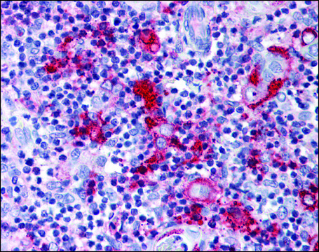 Anti-CCR9 antibody produced in rabbit affinity isolated antibody