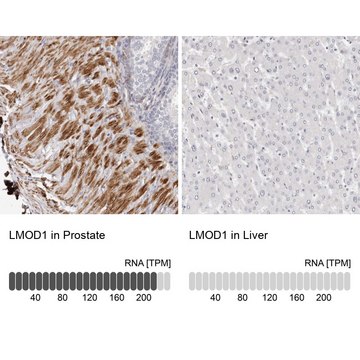 Anti-LMOD1 antibody produced in rabbit Prestige Antibodies&#174; Powered by Atlas Antibodies, affinity isolated antibody, buffered aqueous glycerol solution, ab1