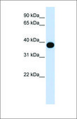 Anti-DEGS1 antibody produced in rabbit affinity isolated antibody