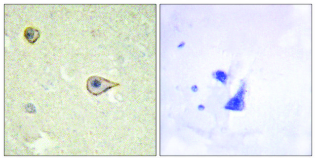 Anti-Cytochrome P450 19A1 antibody produced in rabbit affinity isolated antibody