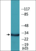 Anti-phospho-C/EBP-ε (pThr74) antibody produced in rabbit affinity isolated antibody