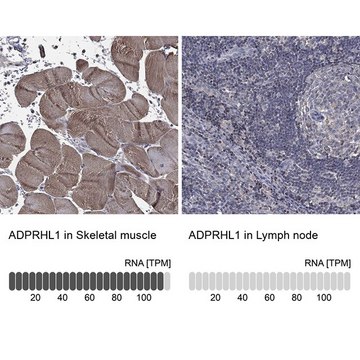 Anti-ADPRHL1 antibody produced in rabbit Prestige Antibodies&#174; Powered by Atlas Antibodies, affinity isolated antibody, buffered aqueous glycerol solution