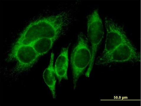 Anti-HK1 antibody produced in mouse purified immunoglobulin, buffered aqueous solution