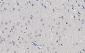 Anti-NG2 Antibody, clone 132.38 ZooMAb® Mouse Monoclonal recombinant, expressed in HEK 293 cells