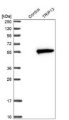 Anti-TRIP13 antibody produced in rabbit Prestige Antibodies® Powered by Atlas Antibodies, affinity isolated antibody, buffered aqueous glycerol solution