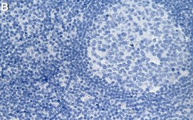 Ani-APPL1 Antibody, clone 2K17 ZooMAb® Rabbit Monoclonal recombinant, expressed in HEK 293 cells