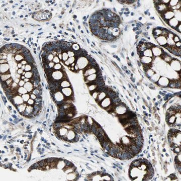 Anti-CHI3L2 antibody produced in rabbit Prestige Antibodies&#174; Powered by Atlas Antibodies, affinity isolated antibody, buffered aqueous glycerol solution