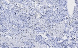 Anti-Zyxin Antibody, clone 2F17 ZooMAb® Rabbit Monoclonal recombinant, expressed in HEK 293 cells