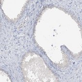 Anti-SCML1 antibody produced in rabbit Prestige Antibodies® Powered by Atlas Antibodies, affinity isolated antibody, buffered aqueous glycerol solution