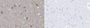 Anti-PSD-95 Antibody, clone 2B20 ZooMAb® Rabbit Monoclonal recombinant, expressed in HEK 293 cells