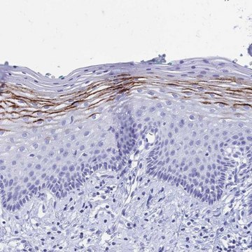 Anti-FA2H antibody produced in rabbit Prestige Antibodies&#174; Powered by Atlas Antibodies, affinity isolated antibody, buffered aqueous glycerol solution