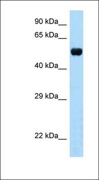 Anti-TAPBPL antibody produced in rabbit affinity isolated antibody