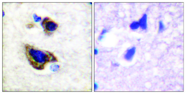 Anti-GFAP antibody produced in rabbit affinity isolated antibody