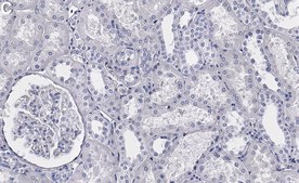 Anti-Raf-1 Antibody, clone 1I3 ZooMAb® Rabbit Monoclonal recombinant, expressed in HEK 293 cells