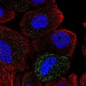 Anti-ABHD14A antibody produced in rabbit Prestige Antibodies&#174; Powered by Atlas Antibodies, affinity isolated antibody