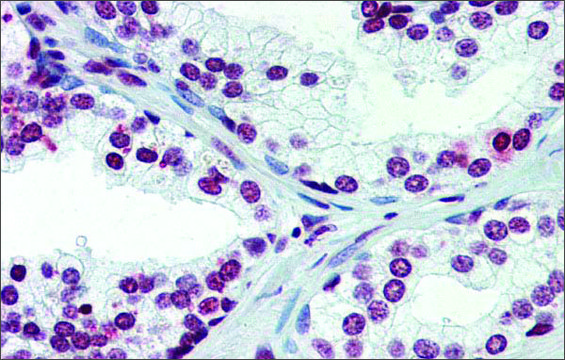 Anti-ARID5A (ab2) antibody produced in rabbit affinity isolated antibody