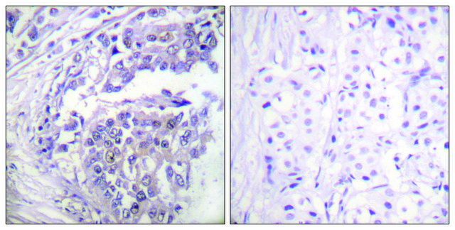 Anti-Histone H2B (Acetyl-Lys5) antibody produced in rabbit affinity isolated antibody