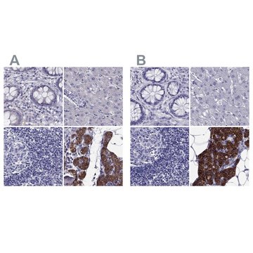 Anti-AAK1 antibody produced in rabbit Prestige Antibodies&#174; Powered by Atlas Antibodies, affinity isolated antibody, buffered aqueous glycerol solution