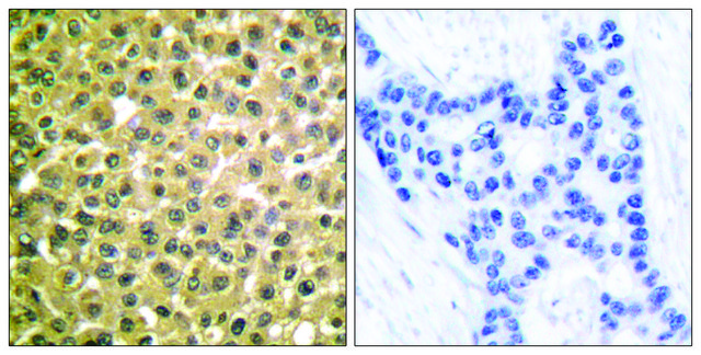 抗-视黄酸受体&#946;，C-末端 兔抗 affinity isolated antibody