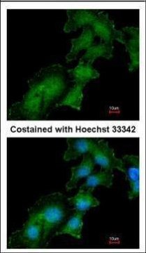 Anti-ATP6AP2 antibody produced in rabbit