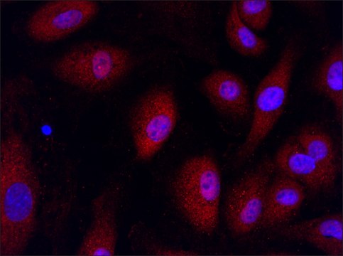 Anti-RNF4 (11-25) antibody produced in rabbit IgG fraction of antiserum, buffered aqueous solution