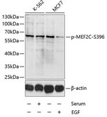 Anti-Phospho-MEF2C-S396 antibody produced in rabbit